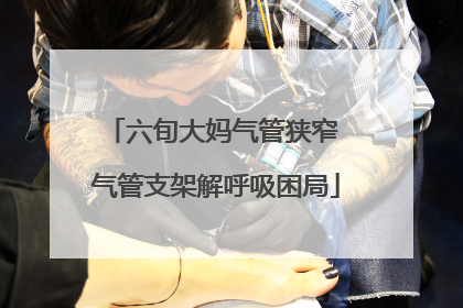 六旬大妈气管狭窄 气管支架解呼吸困局